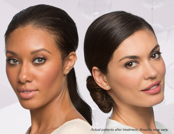 Botox and Juvederm skin rejuvenation services in Fort Worth with products from Allergan, Henry Schein and Galderma. 