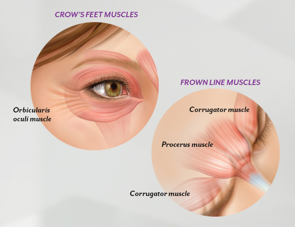 Botox and Juvederm skin rejuvenation services in Fort Worth with products from Allergan, Henry Schein and Galderma. 